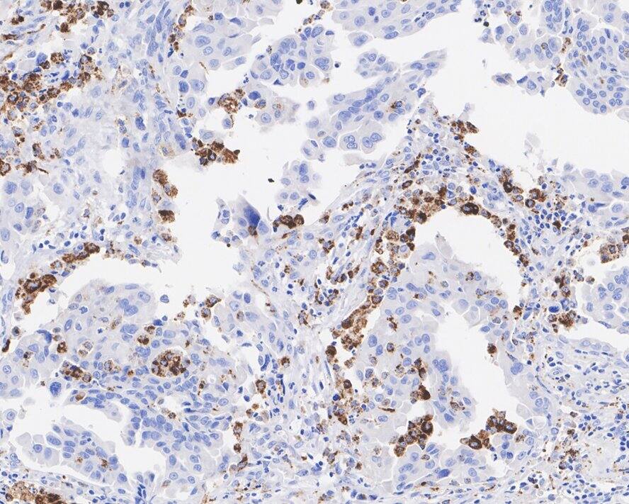 CD68/SR-D1 Antibody (A3C3-R)