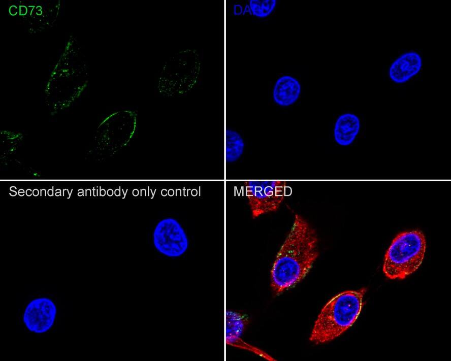 5'-Nucleotidase/CD73 Antibody (A6G2-R)