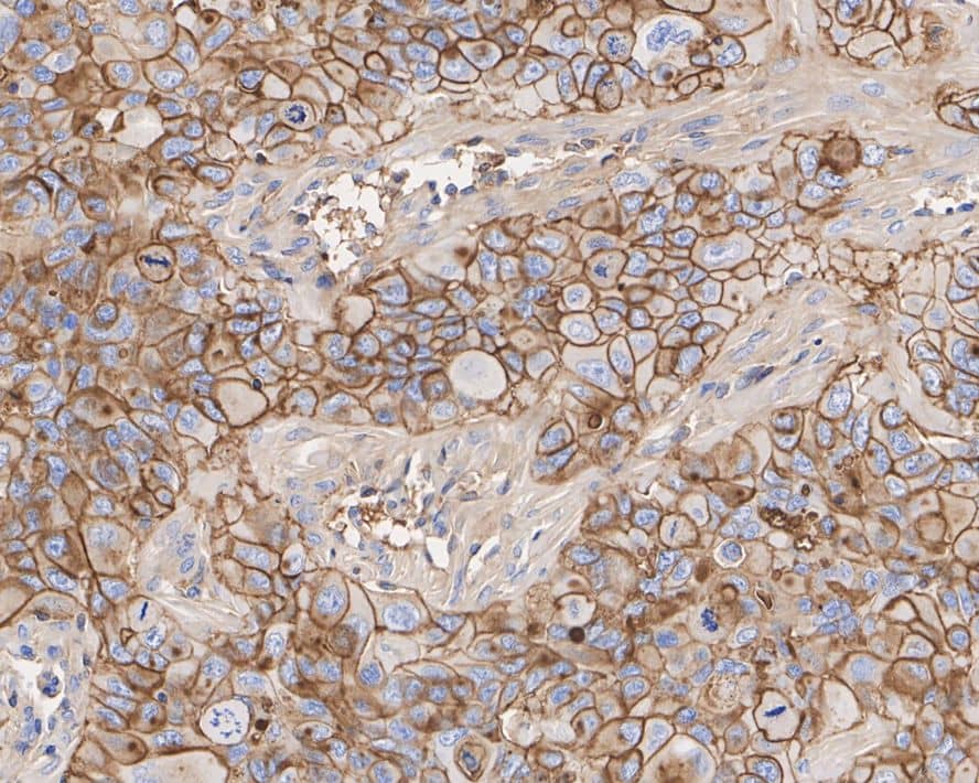 5'-Nucleotidase/CD73 Antibody (A6G2-R)