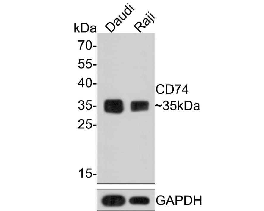 CD74 Antibody (PDM0-22)