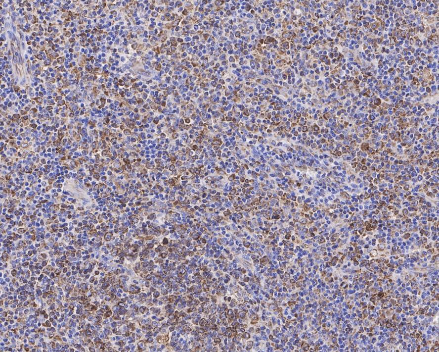 CD74 Antibody (PDM0-22)