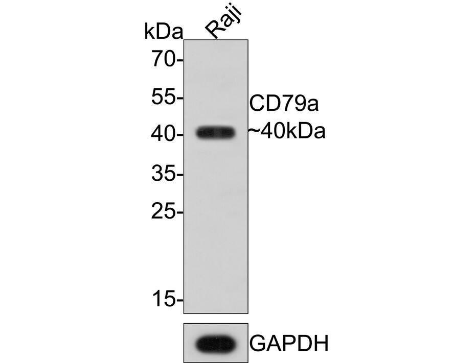 CD79A Antibody (PDM0-23)