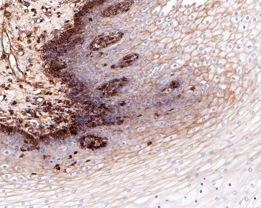 CD99 Antibody (PD00-13)