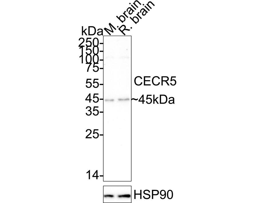 CECR5 Antibody (JE64-76) Western Blot: CECR5 Antibody (JE64-76) [NBP3-32178]