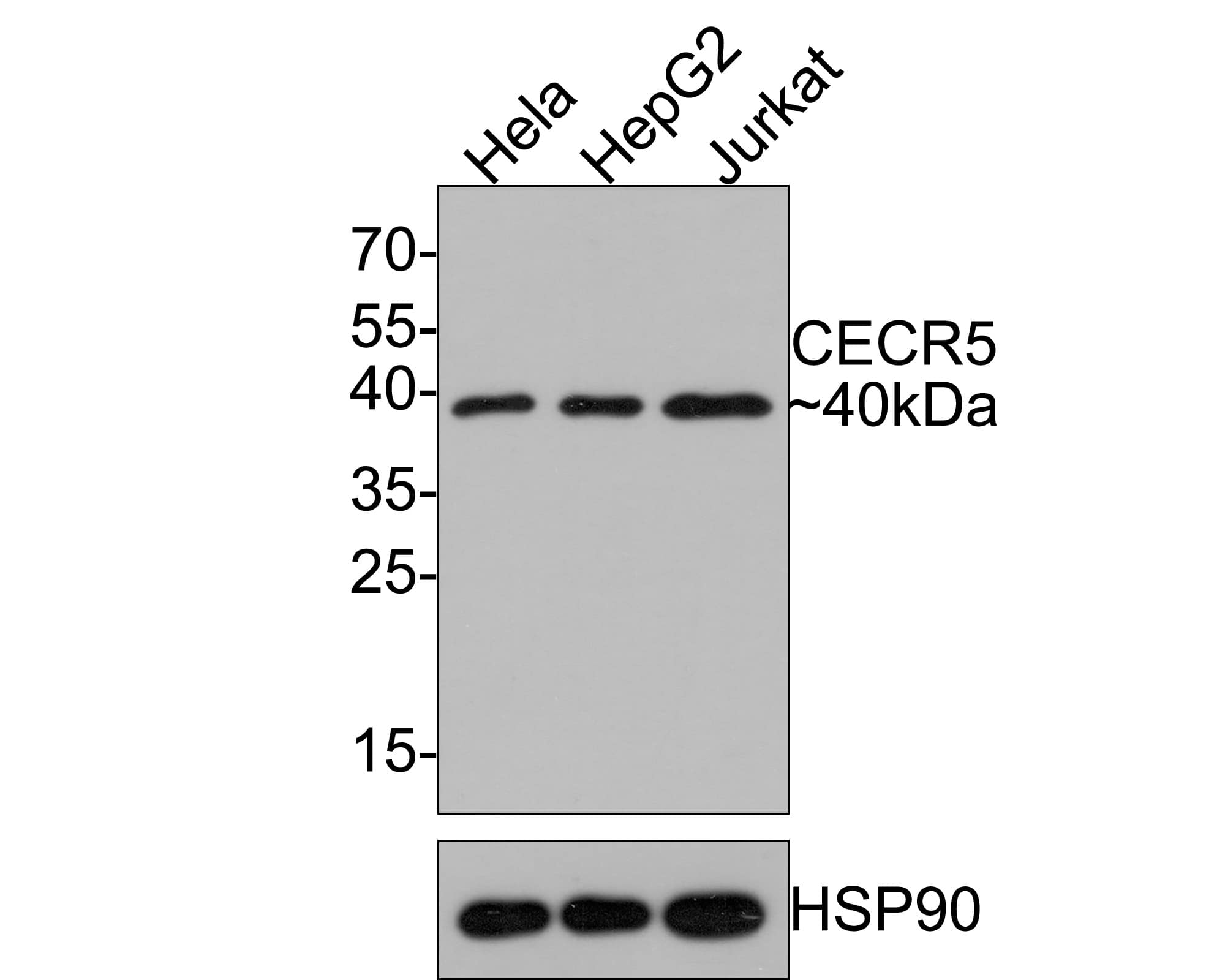 CECR5 Antibody (JE64-76)