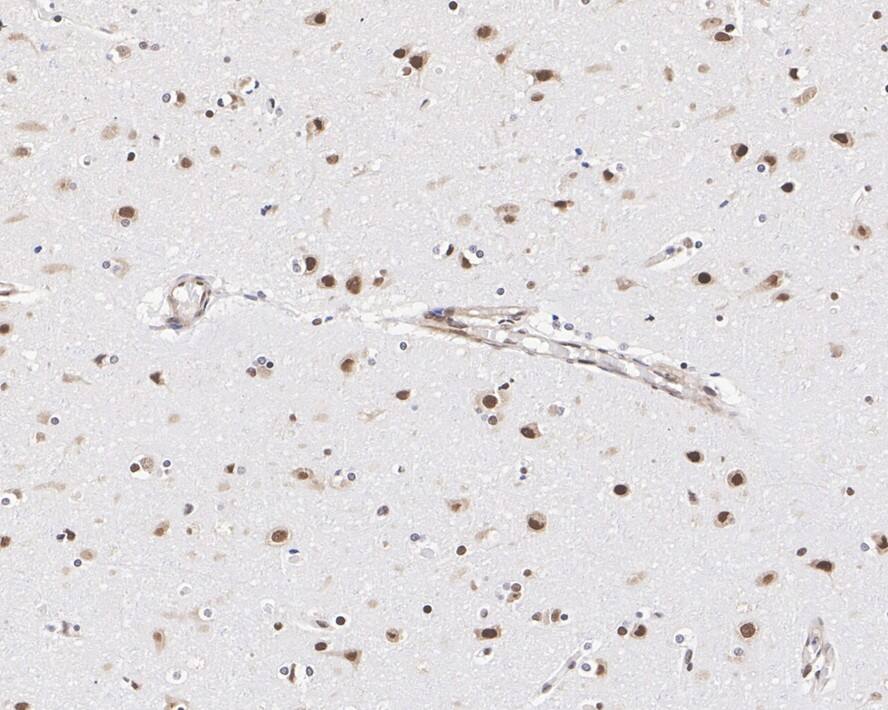 CUGBP1/CELF1 Antibody (7A1-R)