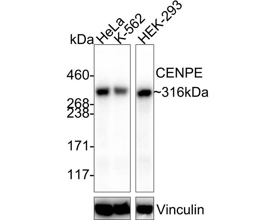 CENPE Antibody (PSH03-54)