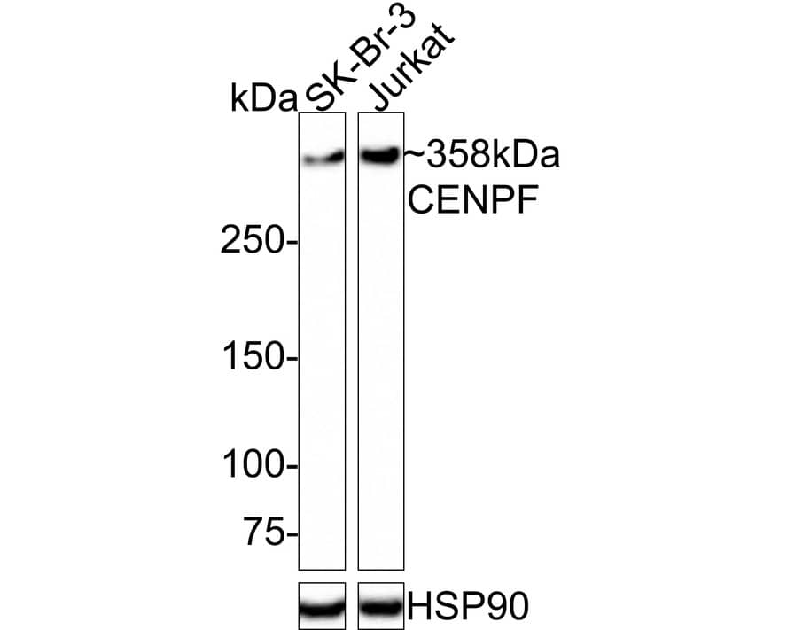 CENPF Antibody (PSH0-79)