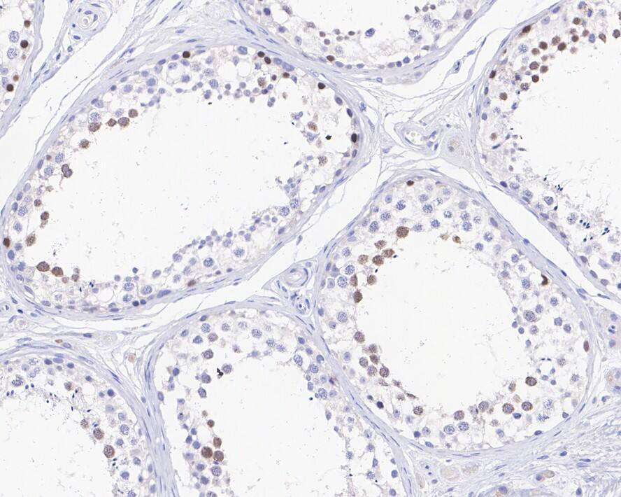 CENPF Antibody (PSH0-79)
