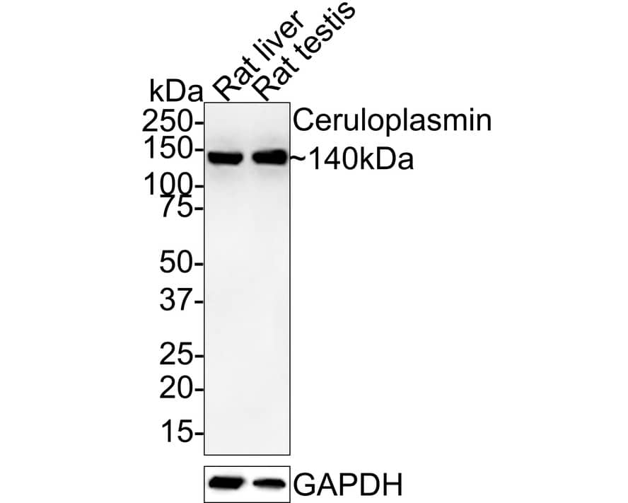 Ceruloplasmin Antibody (JE59-01)