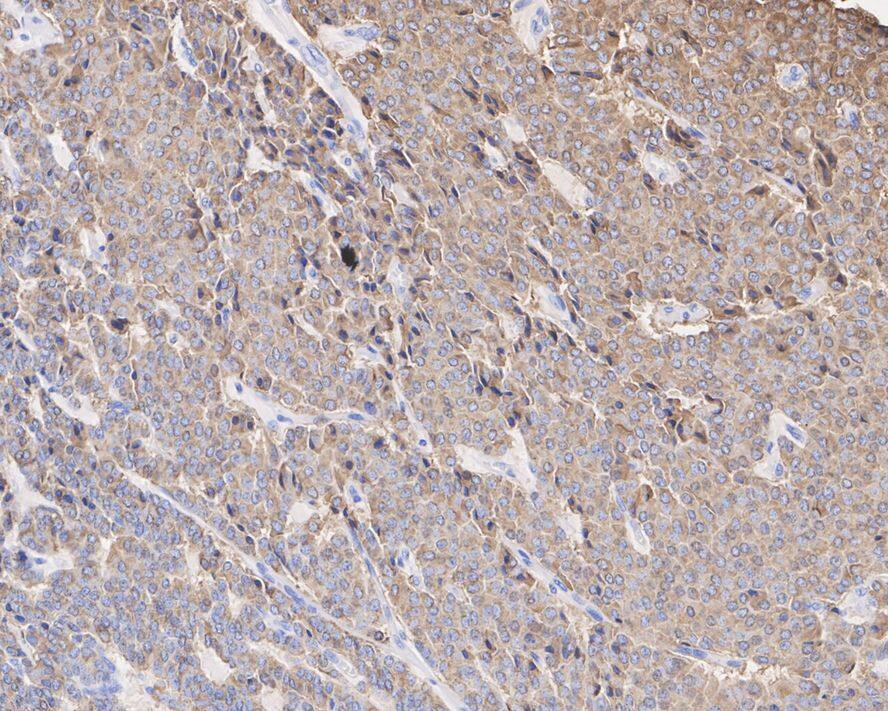 Chromogranin A Antibody (D11-2-R)