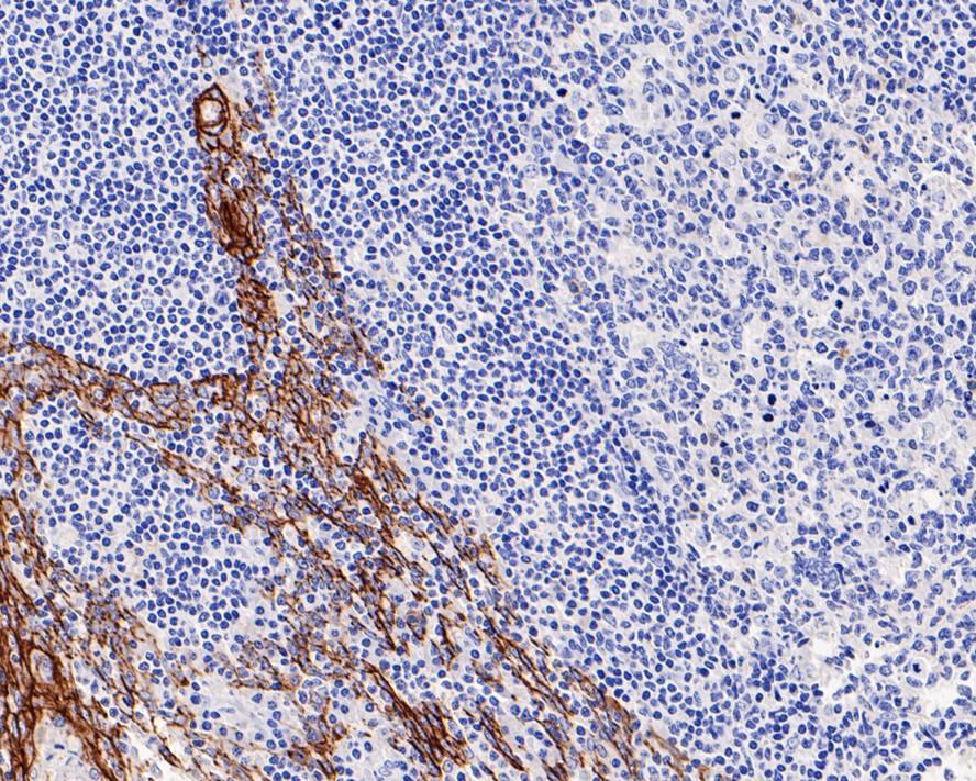 Claudin-1 Antibody (PS01-43)