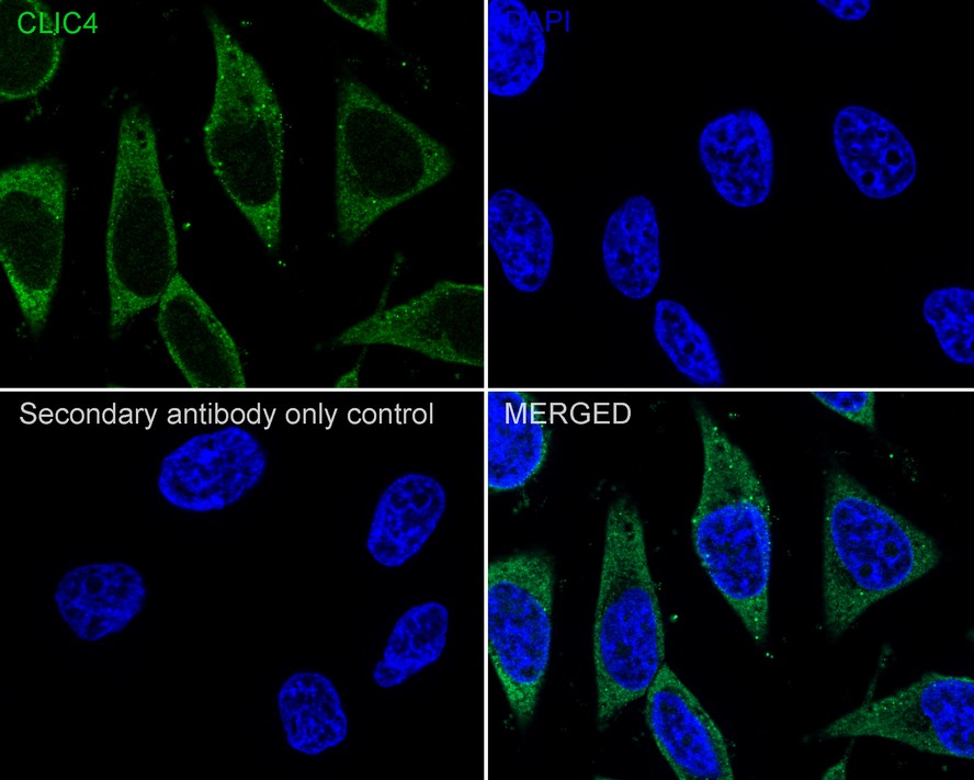 CLIC4 Antibody (JE65-09)