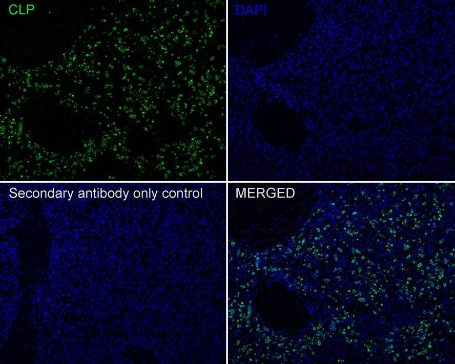 CAMP/LL37/FALL39/Cathelicidin Antibody (PSH01-72)