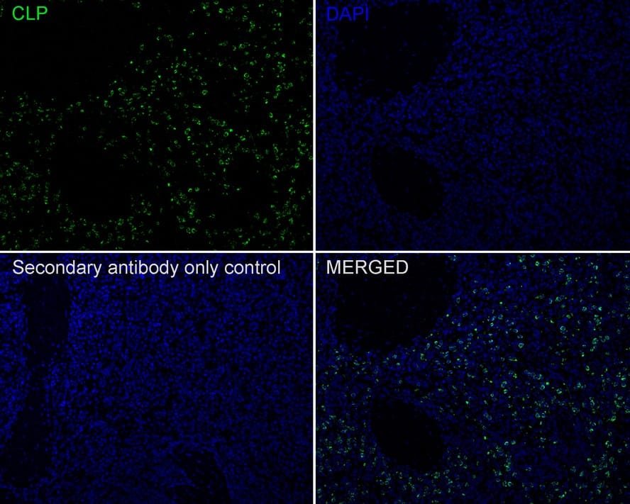 CAMP/LL37/FALL39/Cathelicidin Antibody (PSH01-73)