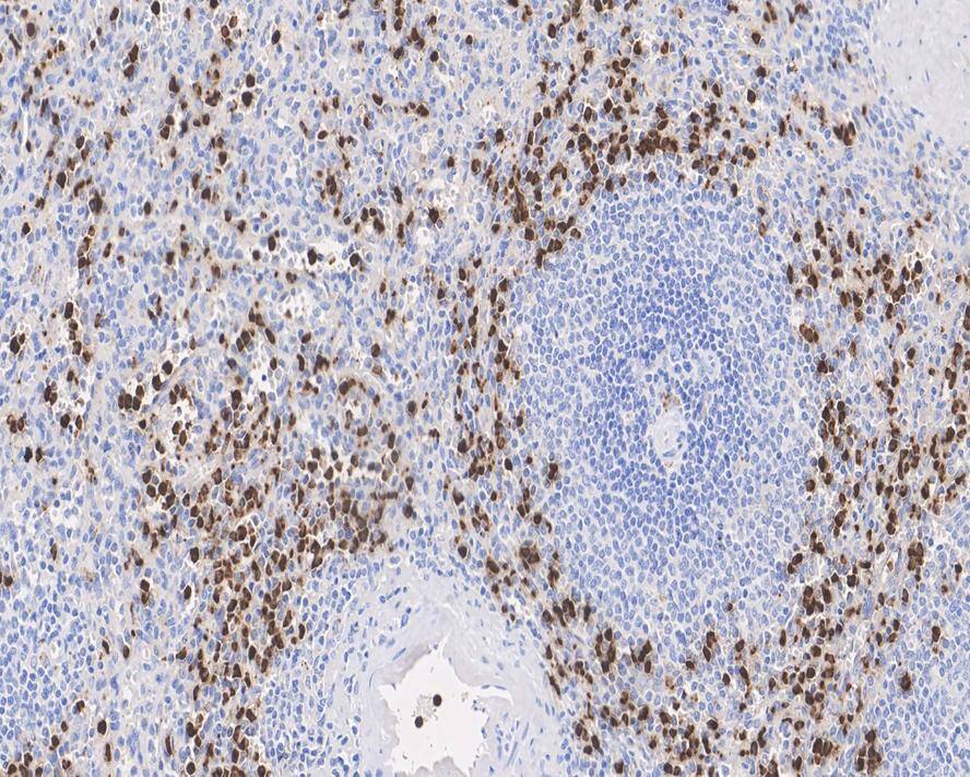 CAMP/LL37/FALL39/Cathelicidin Antibody (PSH01-73)