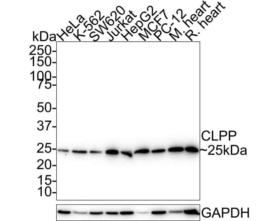 CLPP Antibody (JE40-00)