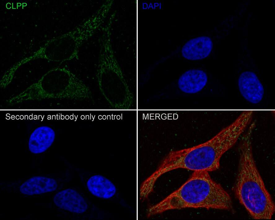CLPP Antibody (JE40-00)