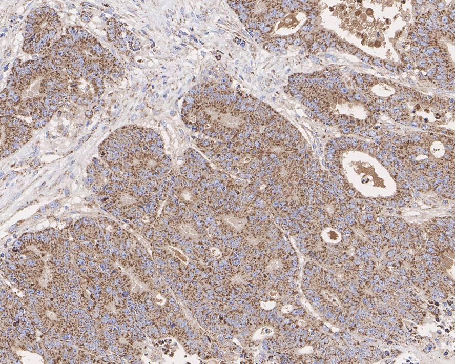 CLPP Antibody (JE40-00)