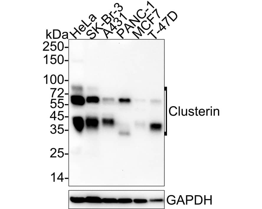 Clusterin/APOJ Antibody (PSH04-33)