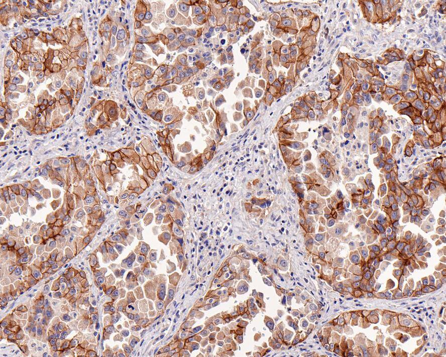 HGFR/c-MET Antibody (A9A4-R)
