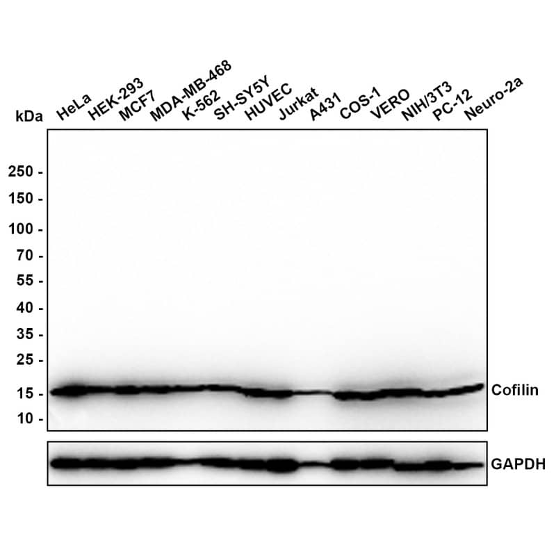 Cofilin Antibody (PSH0-33) Western Blot: Cofilin Antibody (PSH0-33) [NBP3-32204]