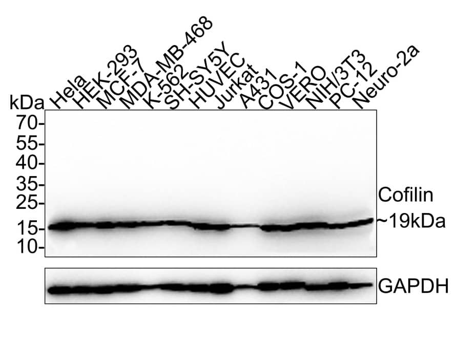 Cofilin Antibody (PSH0-33)