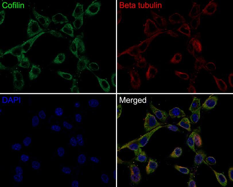 Cofilin Antibody (PSH0-33)