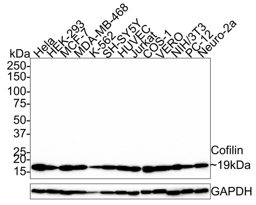 Cofilin Antibody (PSH0-34)