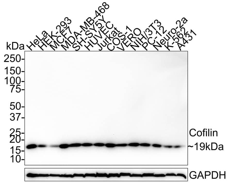 Cofilin Antibody (PSH01-44) Western Blot: Cofilin Antibody (PSH01-44) [NBP3-32207]