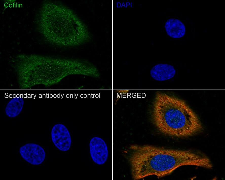 Cofilin Antibody (PSH01-44)