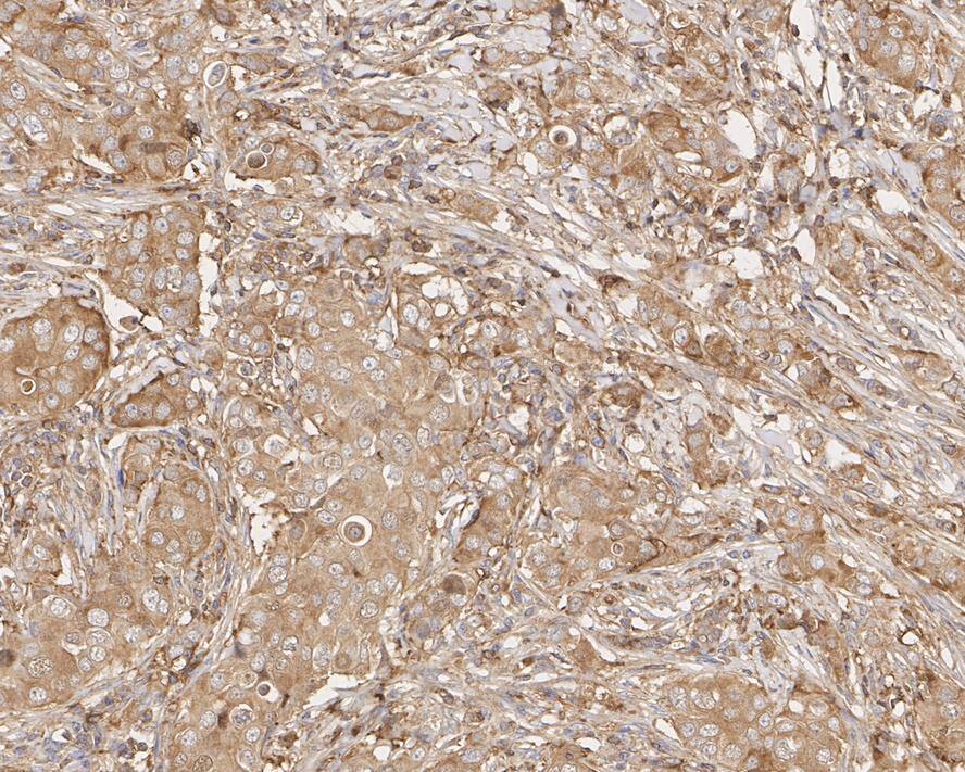 Cofilin Antibody (PSH01-44)