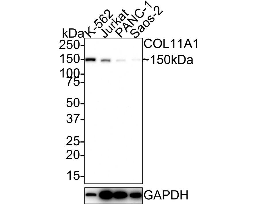 COL11A1 Antibody (JE40-84)