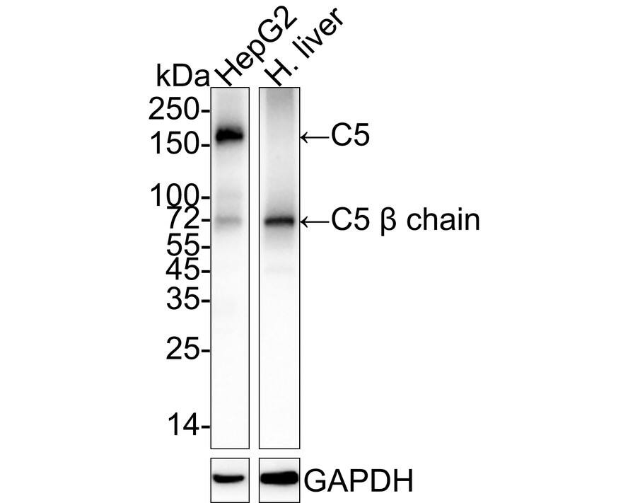 Complement C5 Antibody (PSH04-01) Western Blot: Complement C5 Antibody (PSH04-01) [NBP3-32209]