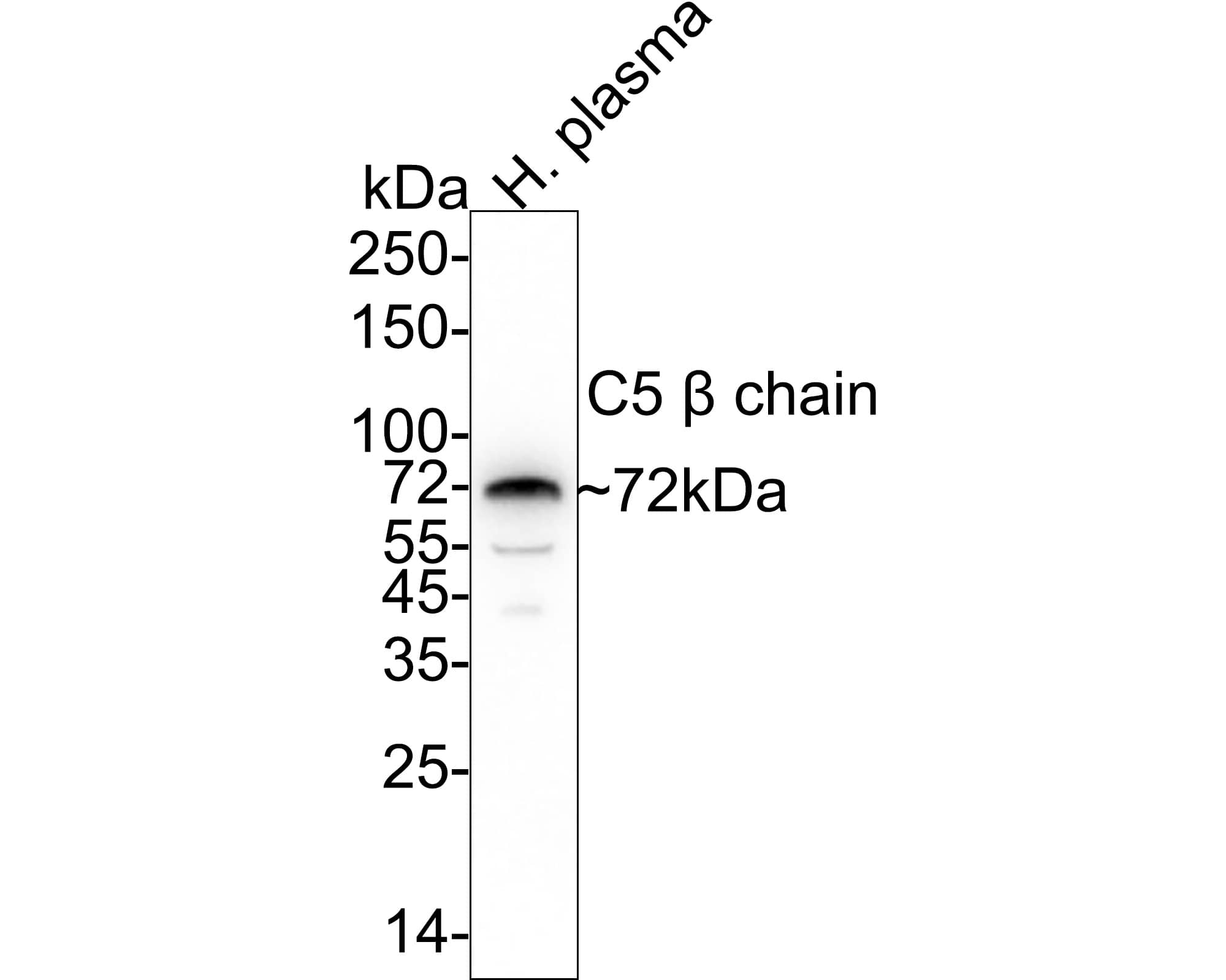 Complement C5 Antibody (PSH04-01) Western Blot: Complement C5 Antibody (PSH04-01) [NBP3-32209]