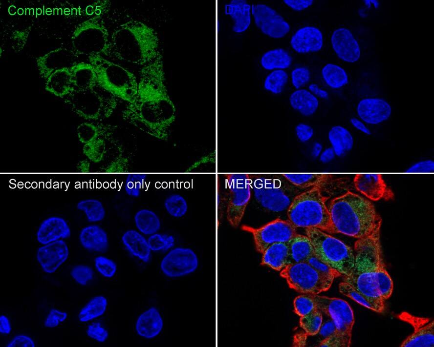 Complement C5 Antibody (PSH04-01)