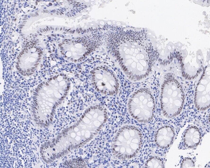 RCOR1/CoREST Antibody (JE35-15)