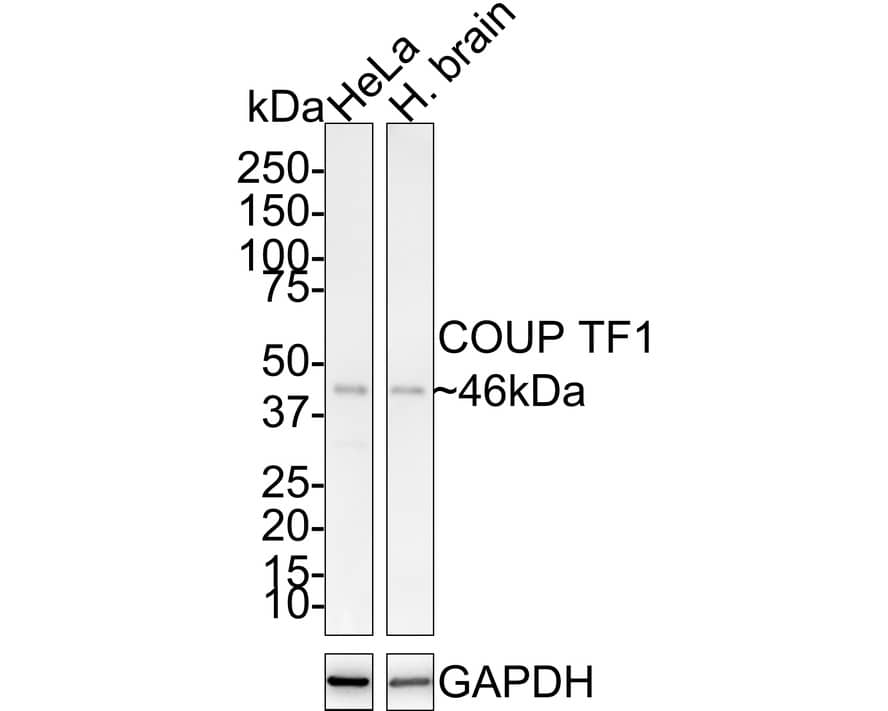 COUP-TF I/NR2F1 Antibody (JE31-95)