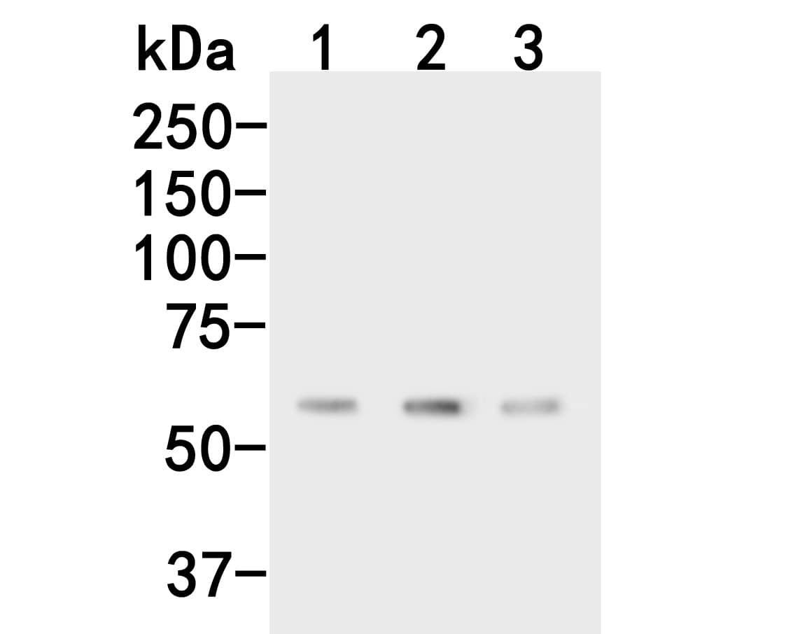 CPN1 Antibody