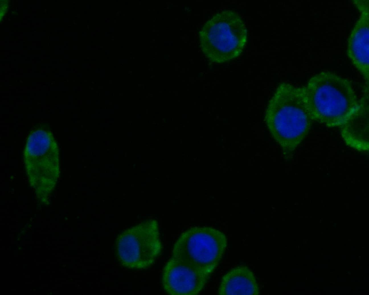 CPN1 Antibody