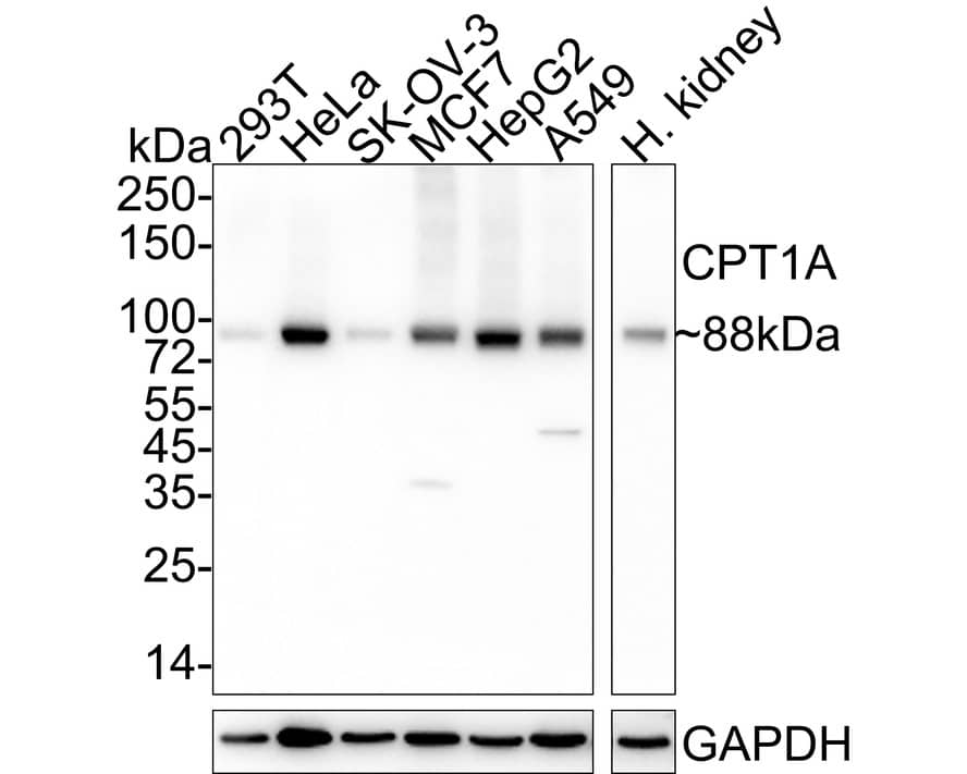 CPT1A Antibody (PSH04-00)