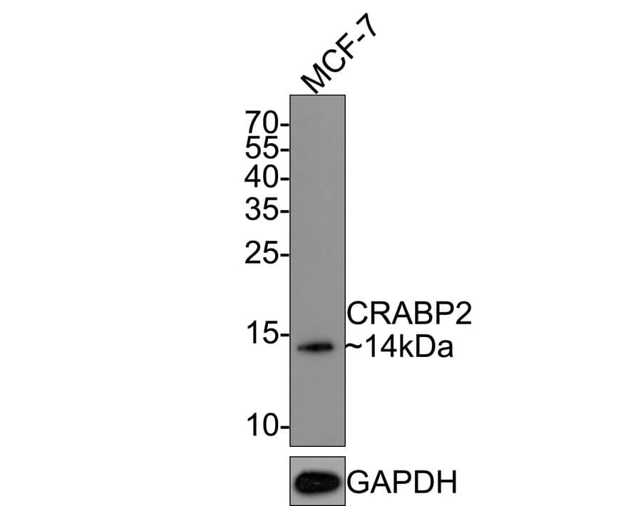 CRABP2 Antibody (JE65-66)