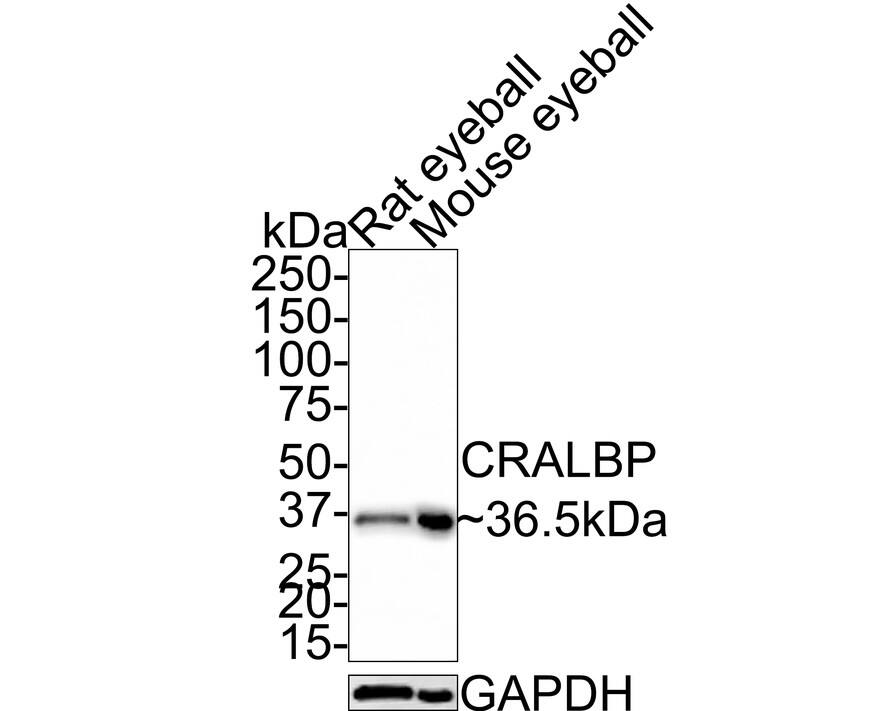 CRALBP Antibody (JE35-09)