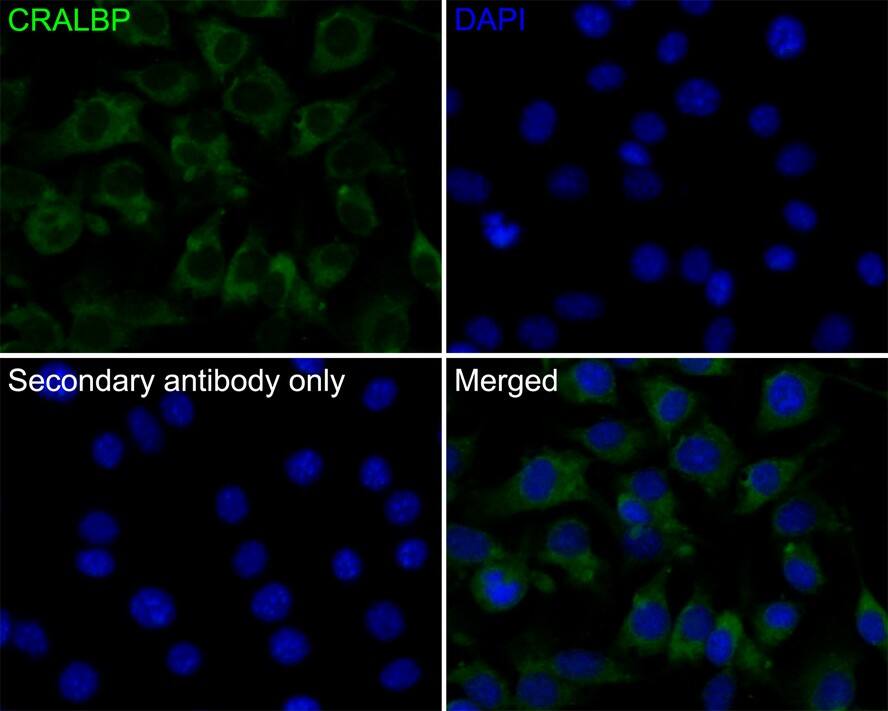 CRALBP Antibody (JE35-09)