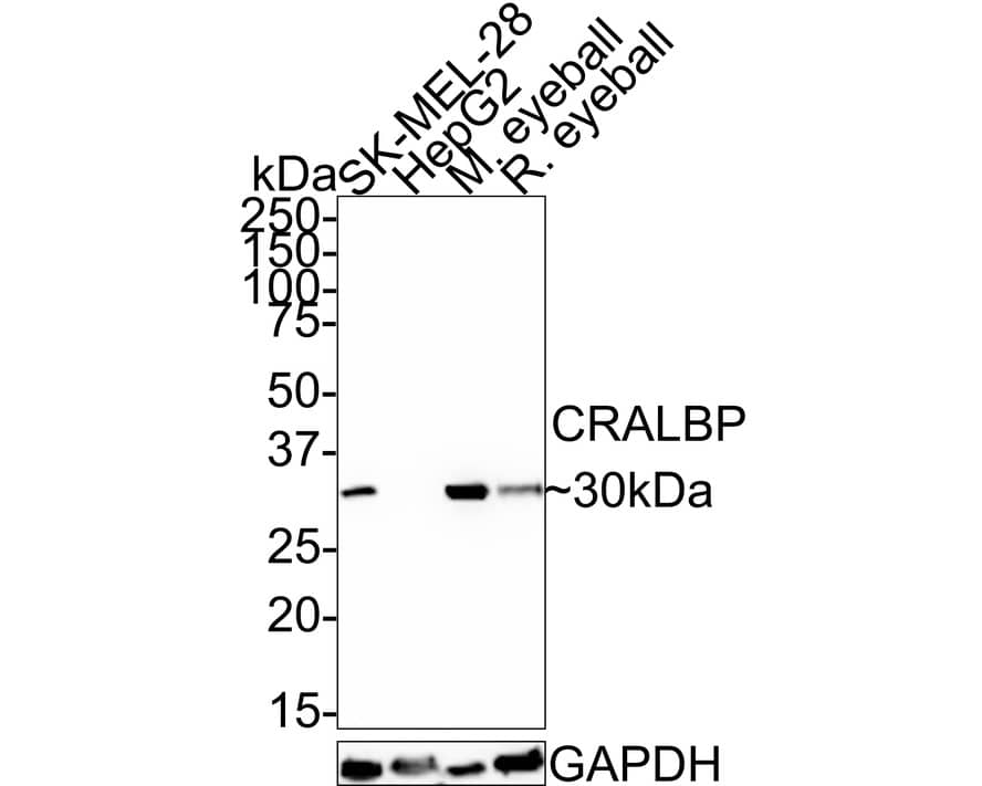 CRALBP Antibody (PSH0-74)