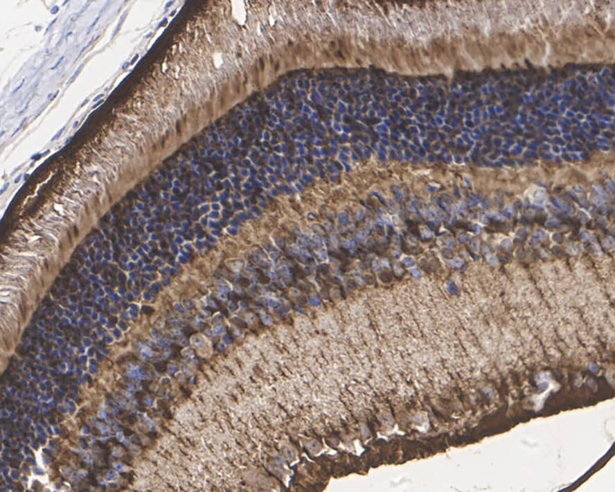 CRALBP Antibody (PSH0-74)