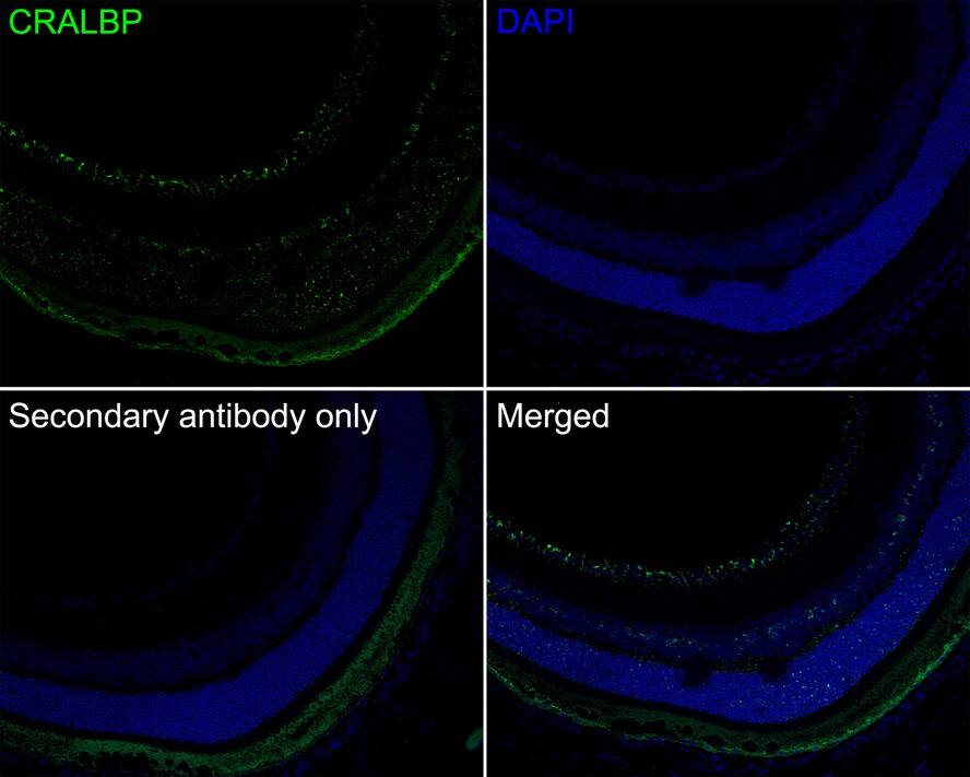 CRALBP Antibody (PSH0-74)
