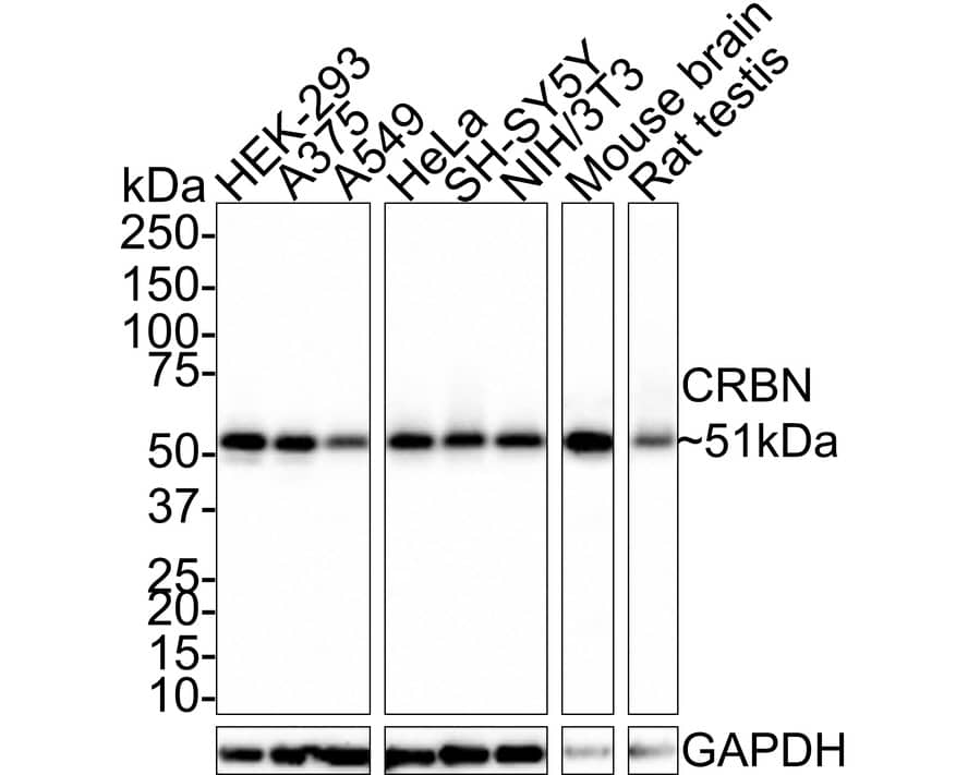 CRBN Antibody (PSH0-70)