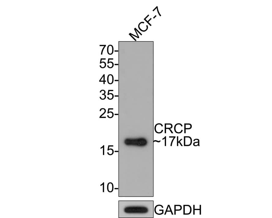 CRCP Antibody (JE65-42)