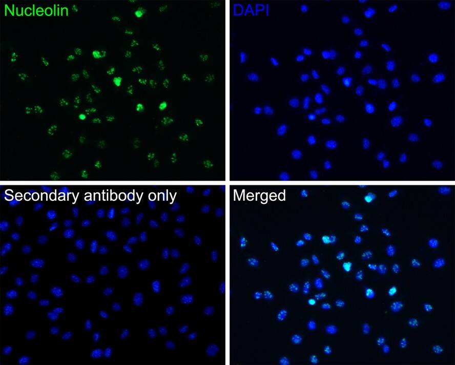 CRCP Antibody (JE65-42)